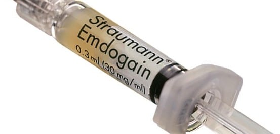 Regenerative Verfahren – smileDentity Dreieich