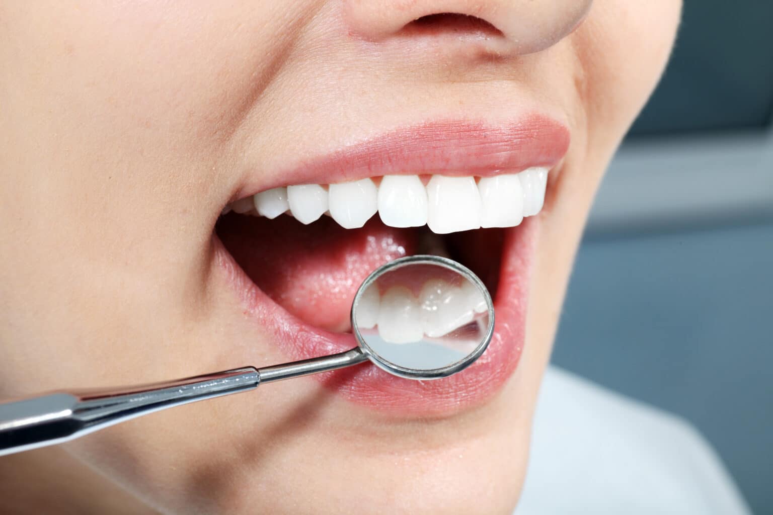 Aphthe an der Lippeninnenseite – smileDentity Dreieich